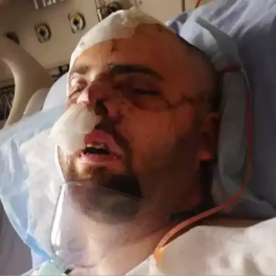 Bear attack survivor wrote chilling final note to loved ones after picking up pieces of his own flesh –